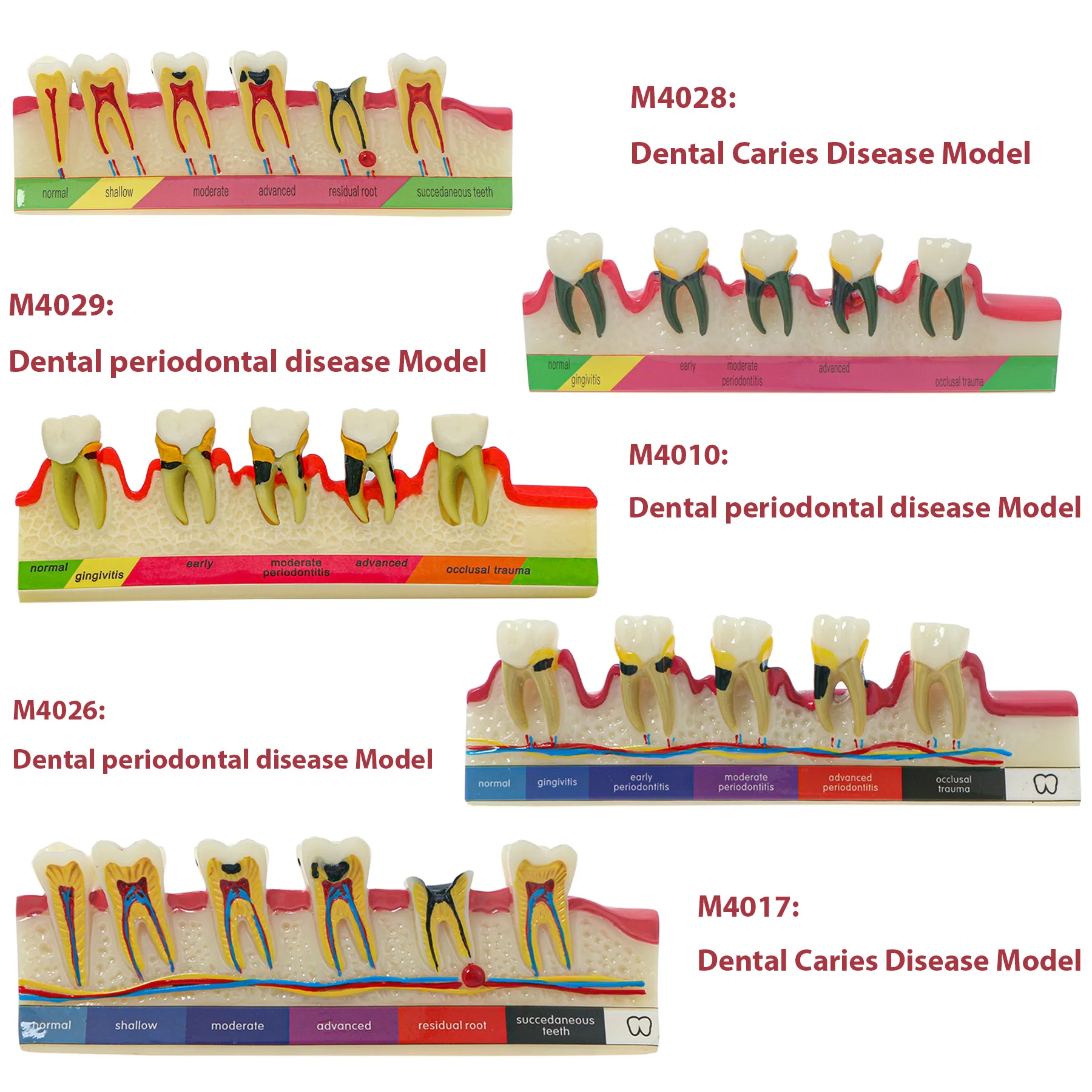 

Dental Periodontal Typodont Teeth Model Caries Teeth Model Disease Assort Demo