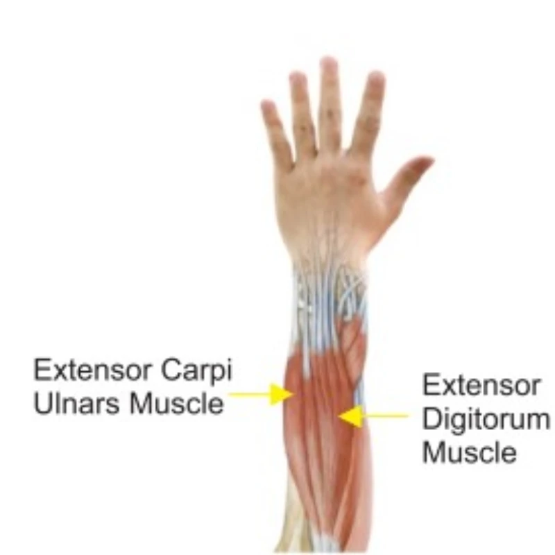 Medical devices Therapeutic Hand Function Rehabilitation Device for stroke Real time detection and analysis Finger and wrist