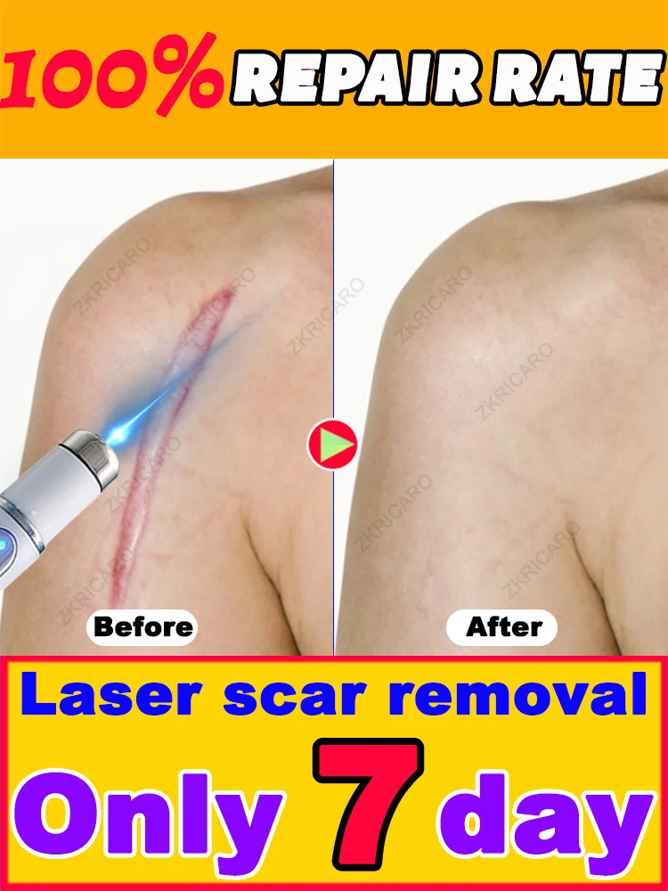 

Make your scars disappear completely