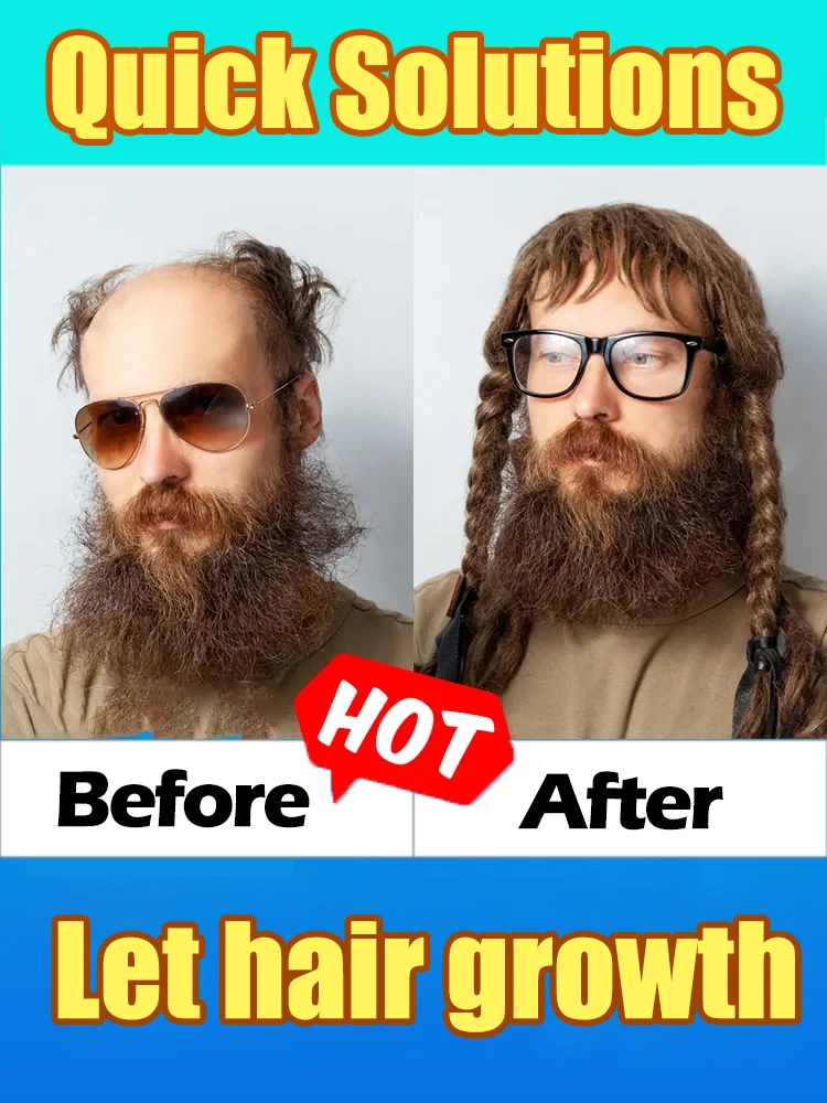 

Want to say goodbye to hair loss Our hair growth products can penetrate the scalp, promote hair growth, and help you regain you