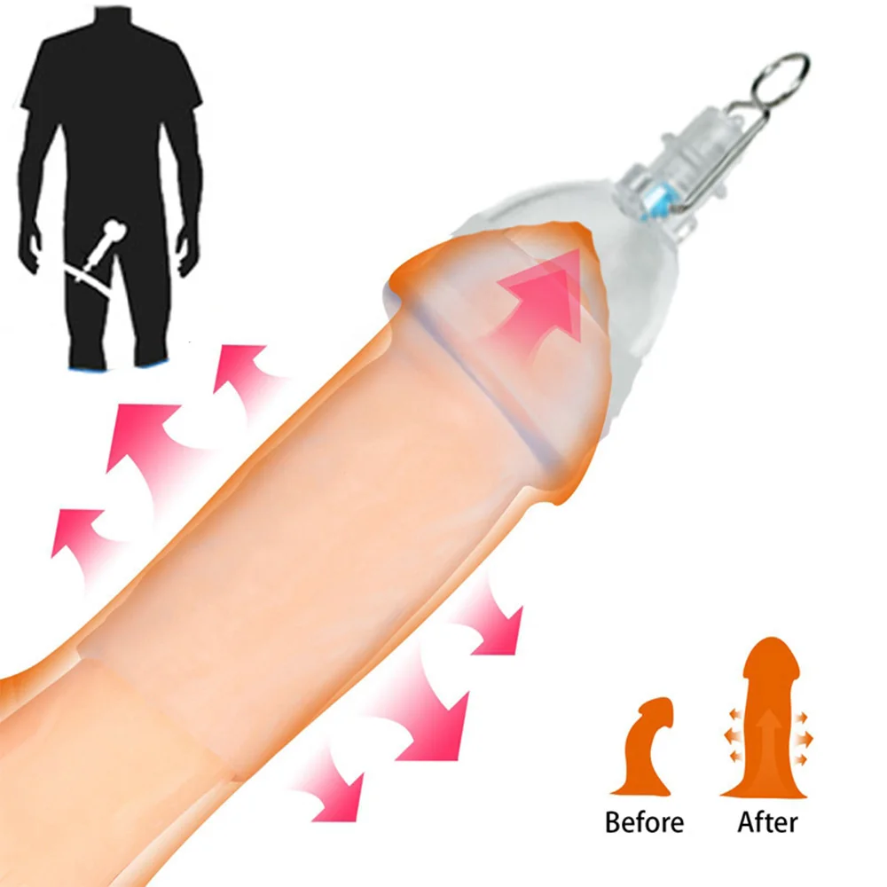 Male Penis Extender Physical Stretch Tie Leg Device Enlarger Set Men Accessories Sleeve Cup Replacement For Cock Stretcher Kit