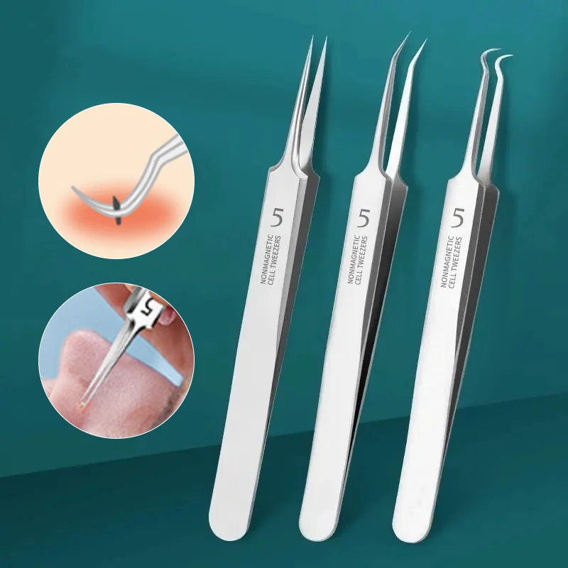 Ultrafijne Mobiele Puistjes Mee-eter Clip Pincet Schoonheidssalon Remover Acne Naald Mee-eter Diepe Schonere Clip Gezicht Huidverzorging tool