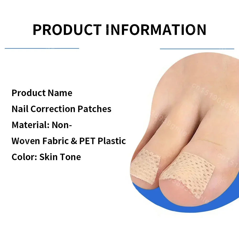 Ingrown Toenail Correction Tool Nail Filling Pad Ingrown Toe Nail Treatment Elastic Patch Straightening Clip Brace Pedicure Tool