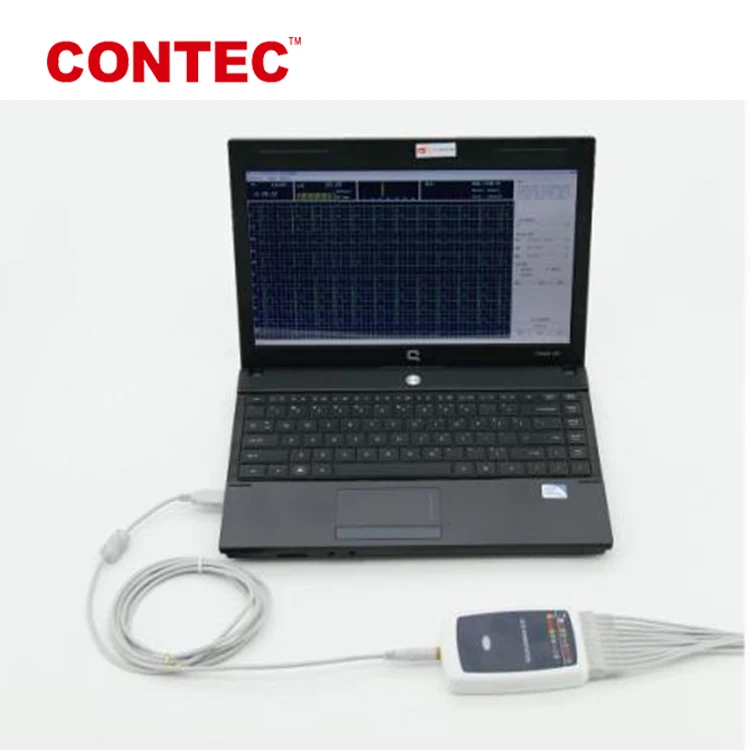 CONTEC8000GW  Machine 3 12 Leads  EKG Analysis Diagnosis Device Recording System