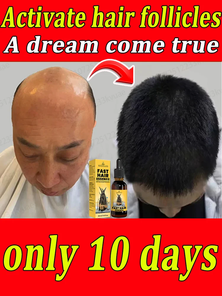

Say goodbye to baldness, hair growth essential oil will make your hair grow so long that the comb will burst