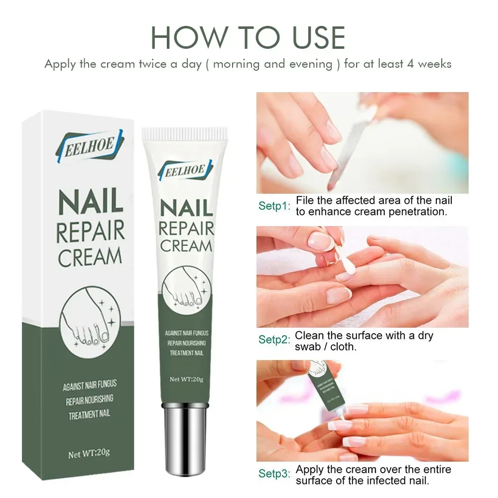 Repair Cream Rapid Removal of Grey Nail Repair Nail Care Ointment Thickening Soft Nail Cream Gel Foot Care Callus Remover