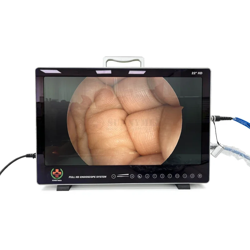 SY-PS050 22 Inch 4 in 1 HD Endoscopy  Unit for ENT/Hysteroscop Endoscope System for Hospital/Clinic