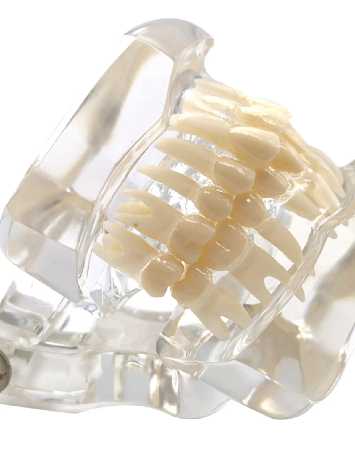 Modello didattico dentale Ortho Metallo/Ceramica Con/Senza staffa Accessori per odontoiatria Ortodonzia Strumento per modellare i denti finti