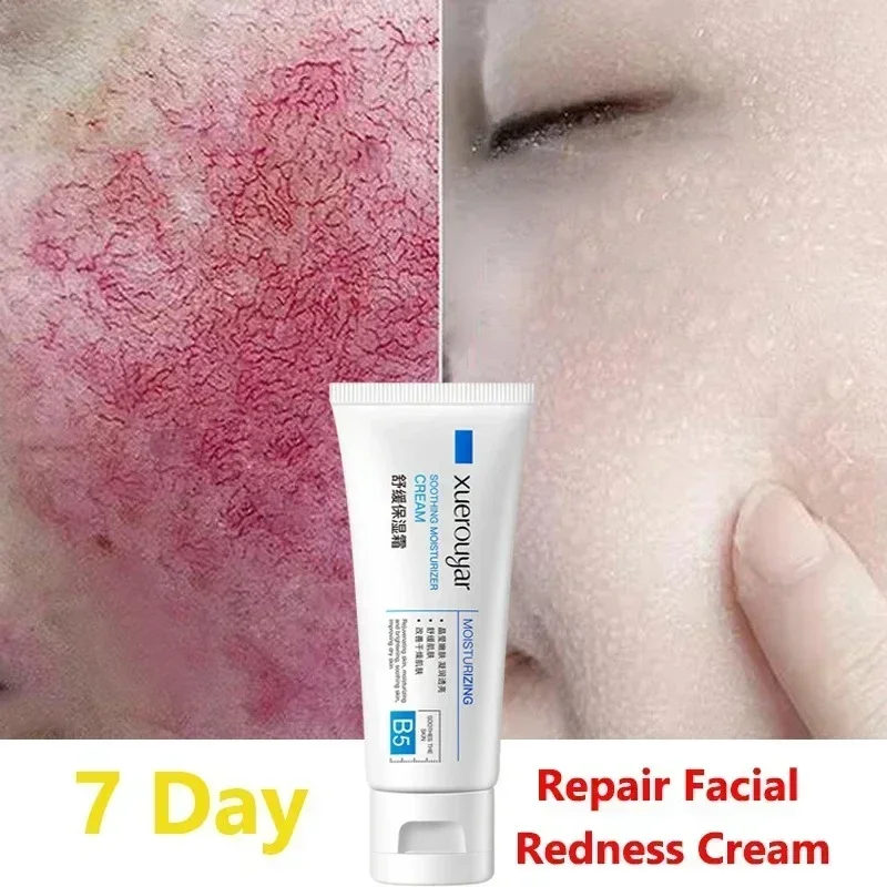 

7 Day Repair Facial Redness Cream Soothing Redness Repair Skin Rosacea Red Blood Improve Sensitive Skin CareKorean Cosmetic