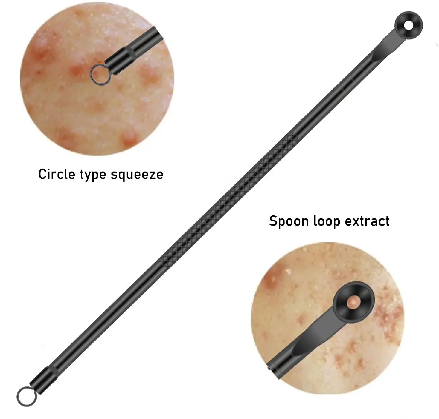 مجموعة 4 إبر احترافية للرؤوس السوداء للوجه، مستخرج الرؤوس السوداء للرؤوس البيضاء من الفولاذ المقاوم للصدأ، أداة تنظيف عميقة للوجه #4