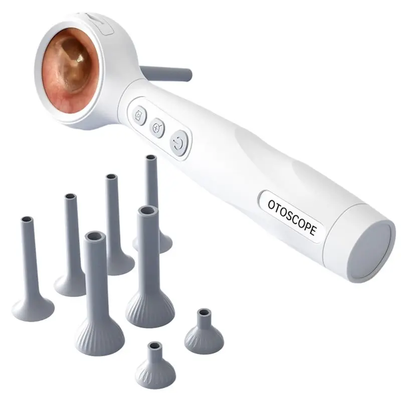 

【CYBER MONDAY】Portable 1080P HD Digital Otoscope Camera 1.38" Screen Visual Ear Cleaner Video Ear Endoscope For Ear Wax Removal
