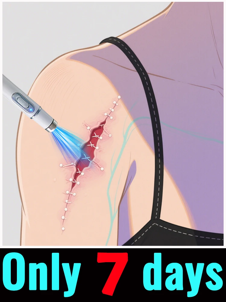 ซ่อมแซมรอยแผลเป็นจากโรคริดสีบ์ ทำให้ผิวเรียบเนียนเป็นธรรมชาติ