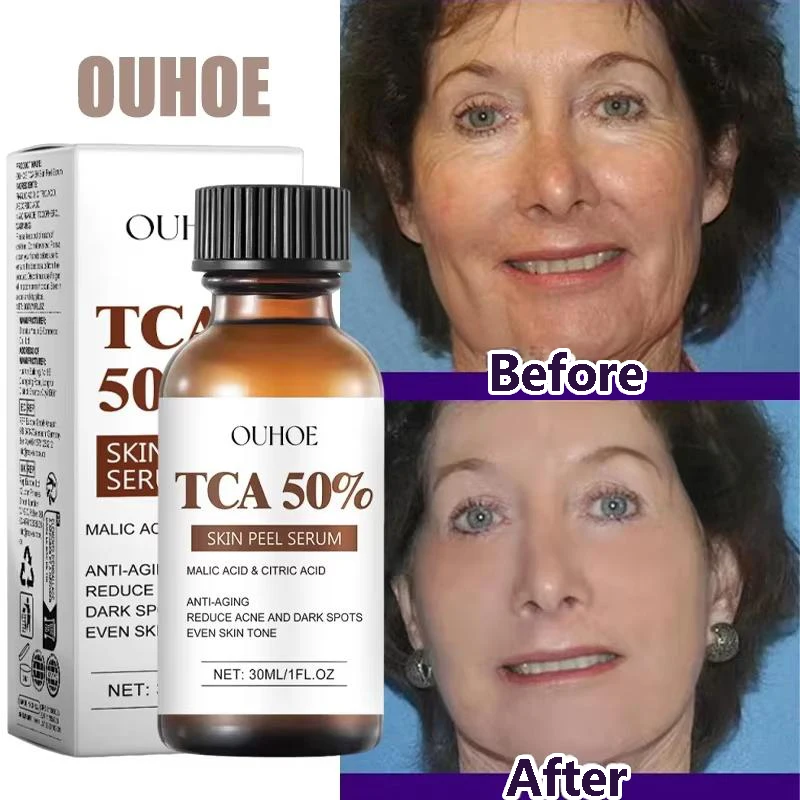 

TCA 50% Remove Wrinkle Face Serum Firming Lifting Anti-Aging Shrink Pore Whitening Essence Repairing Korean Skin Care Products