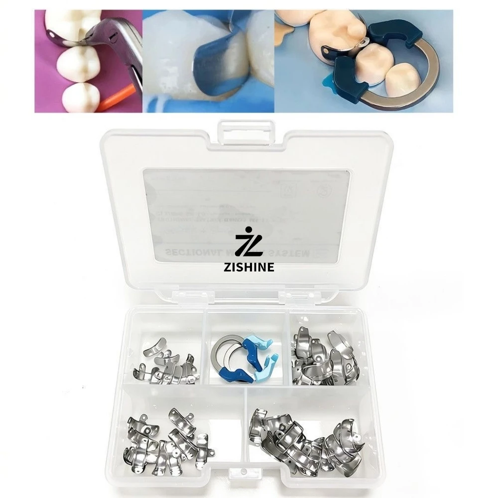 Dental Sectional Matrix System Ni-Ti Clamps Matrix Bands 3.5/4.5/5.5/6.5mm Premolar Separation Ring Teeth Restoration Tools
