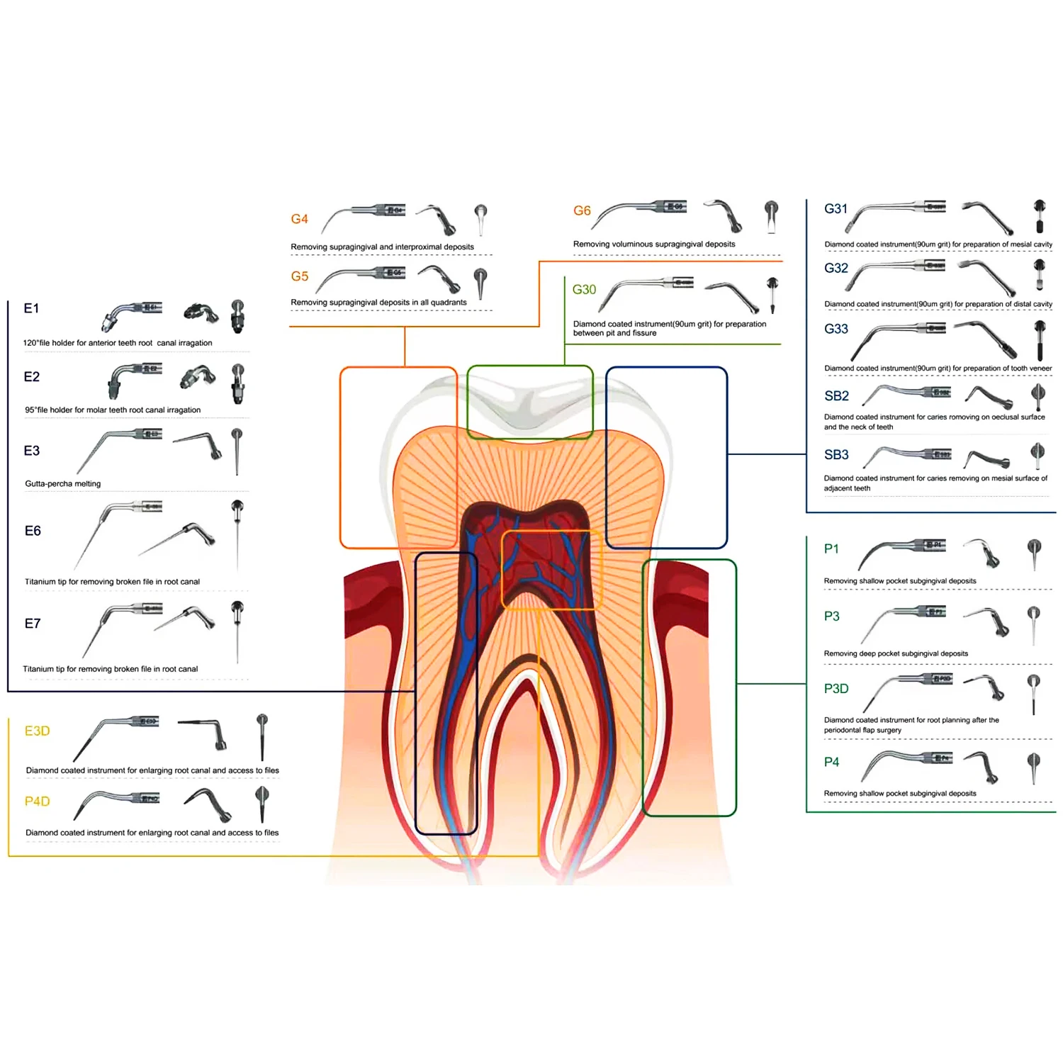 JOLANT 1pc Dental Raspador Ultrassônico Ponta Escala Perodontia Endodontia GD PD ED Ponta Apto para SATELEC DTE NSK Raspador Ultrassônico