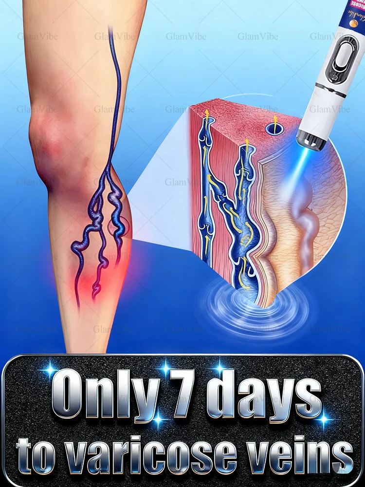 El lápiz de reparación de piernas con tratamiento láser alivia la hinchazón y el desconforto de las piernas.