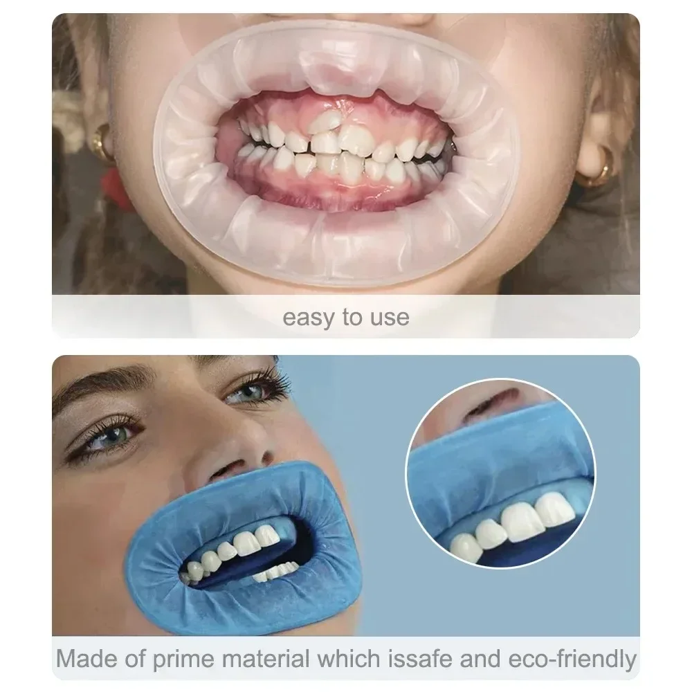 

JUMTOP Dental Mouth Opener Kit - 10PCS O-Shape Rubber Dam Cheek Retractors for Oral Surgery and Dental Procedures