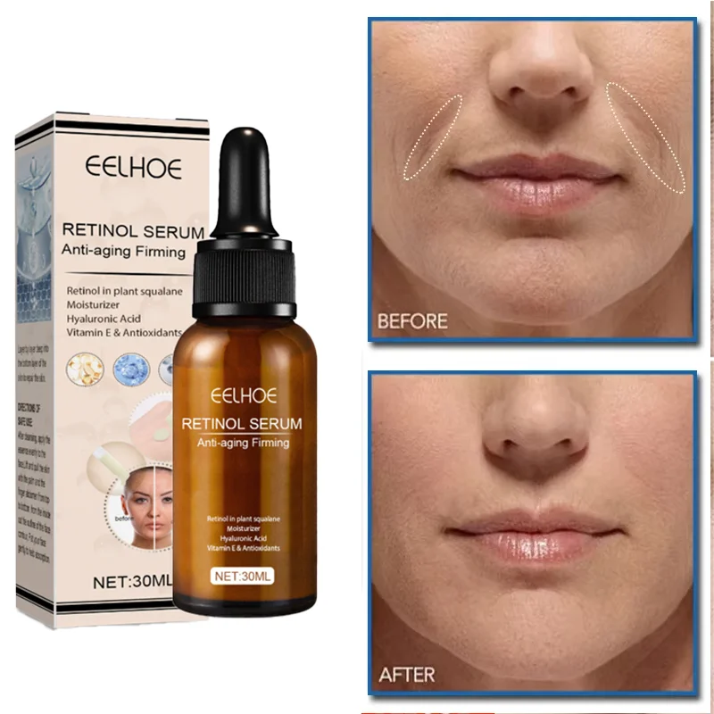 

Retinol Anti-Wrinkle Serum Lifting Firming Repair Improve Removal Nourishing Face Skin Hyaluronic Acid Essence Korean Skincare