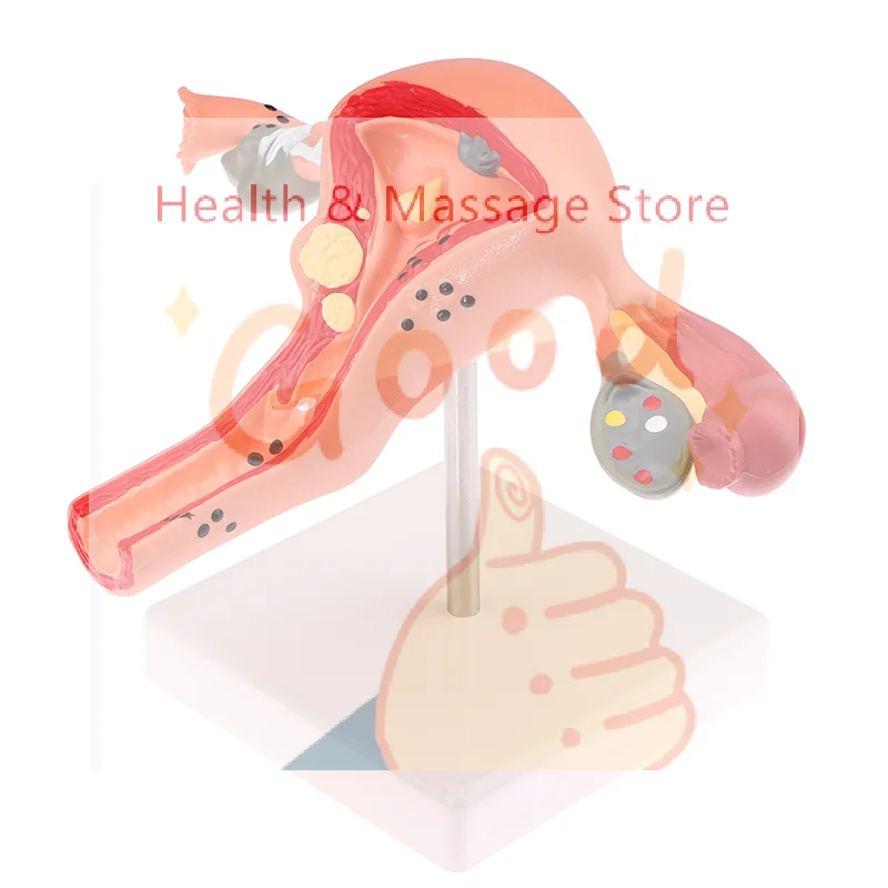 

【WA】1Pcs Medical Props Model Pathological Uterus Ovary Anatomical Model Anatomy Cross Section Study Tool