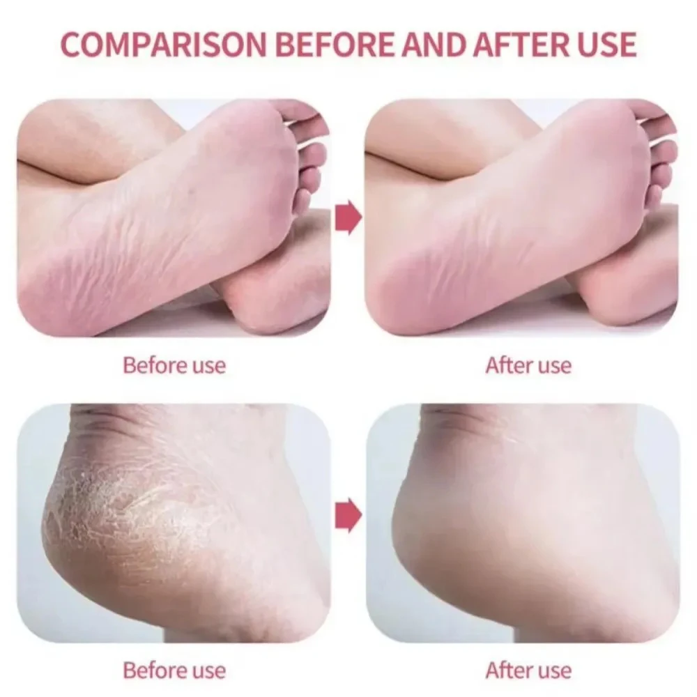 ตะไบเท้านาโนแก้วแบบด้านเดียว ขัดผิวเท้า ขจัดหนังด้าน หนังกำพร้า ตะไบขัดเท้า อุปกรณ์ดูแลเท้า