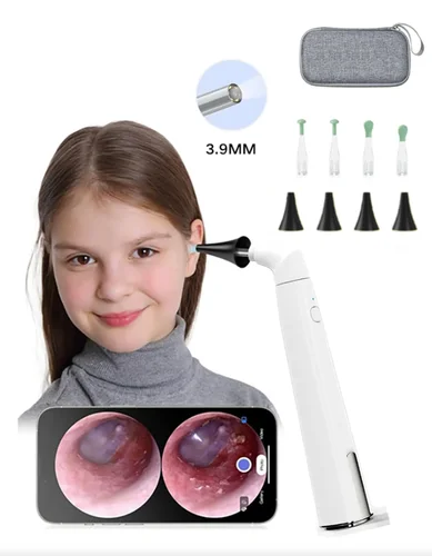 Endoscopio Visual para oreja, otoscopio inalámbrico WiFi, eliminación de cera de los oídos, 3,9mm, 720P, toma de imágenes y vídeos, Compatible con IOS y Android