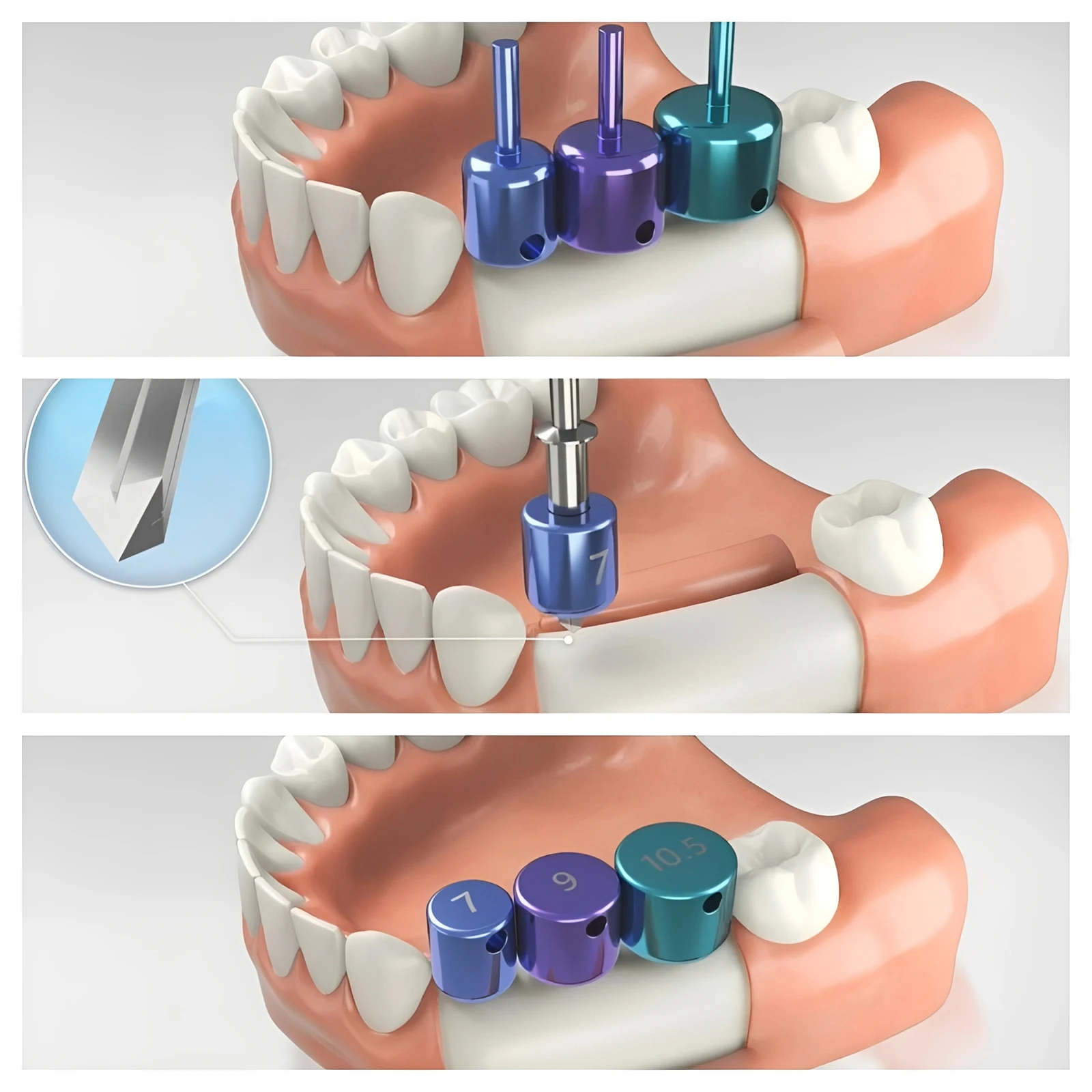 Universal 19 Pcs Fu…