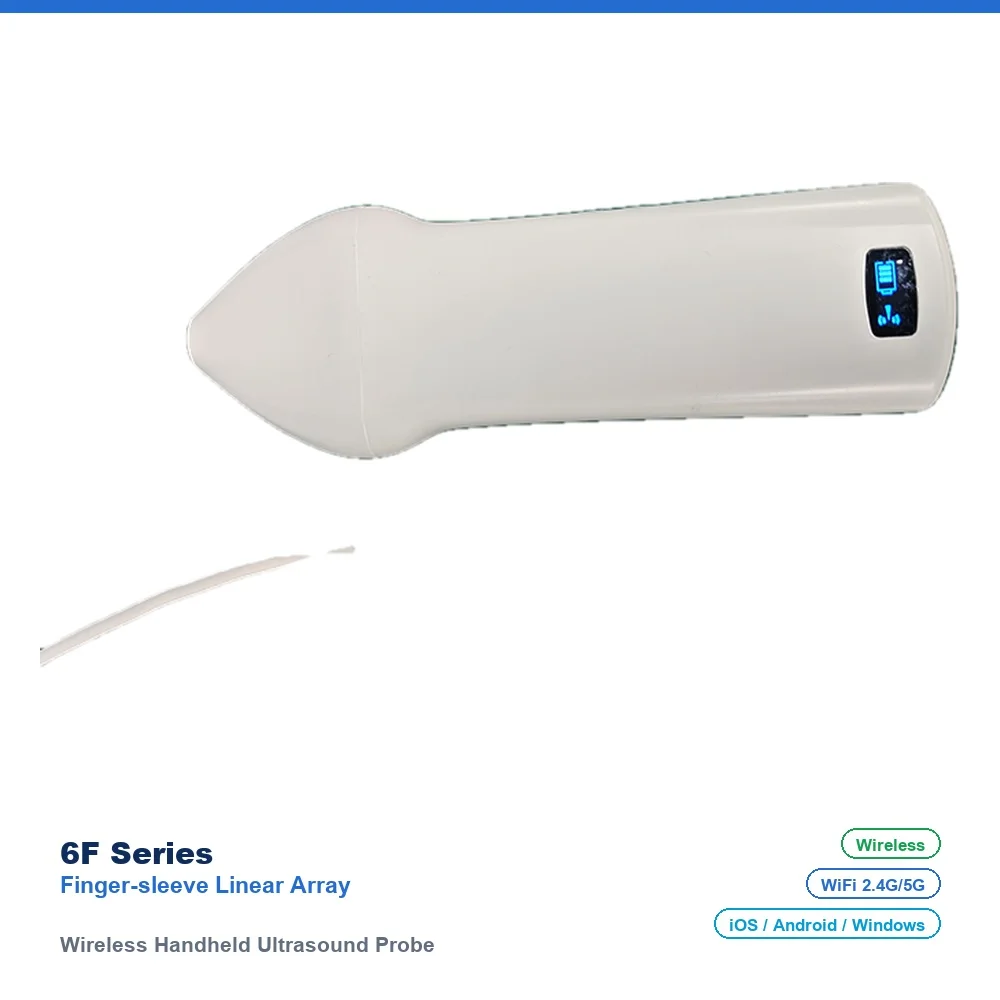 6F Wireless Handheld Ultrasound Probe, Finger-sleeve Linear Array, 192 Elements, 32 Channels, 7.5/10.0MHz, for Thyroid, Breast