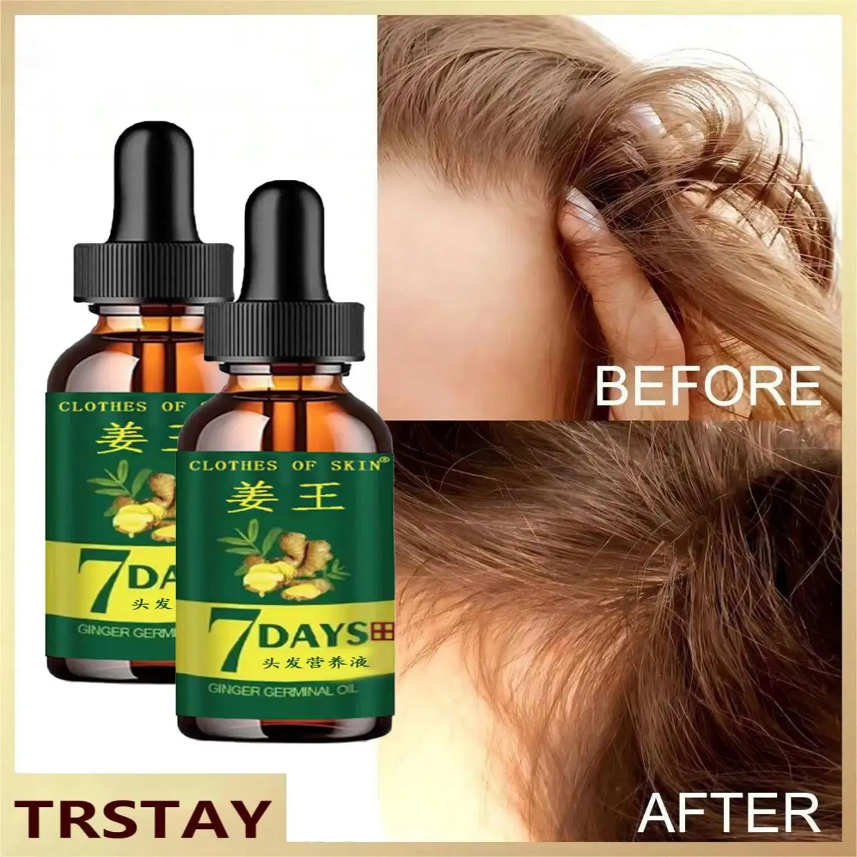 TRSTAY Hair Care Essential Oil Refreshing Nourishing Scalp Hair Follicle Nutrient Solution Strong Hair Hair Care