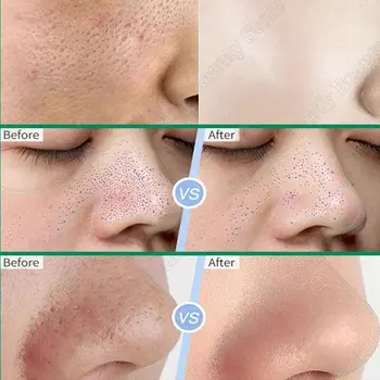 水楊酸毛孔清潔霜 收縮毛孔 去除黑頭粉刺 提亮膚色 保濕柔滑肌膚 韓國產品 10 最佳銷售 韓式奶油 - №2