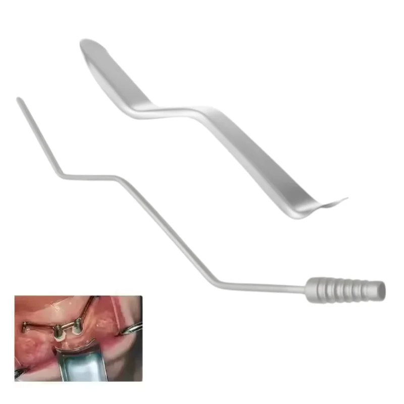 

1 шт. Зубной роторасширитель S-образной формы из нержавеющей стали с отдельной отсасывающей трубкой, крючок для губ, хирургический инструмент для имплантации, расширитель ротовой полости