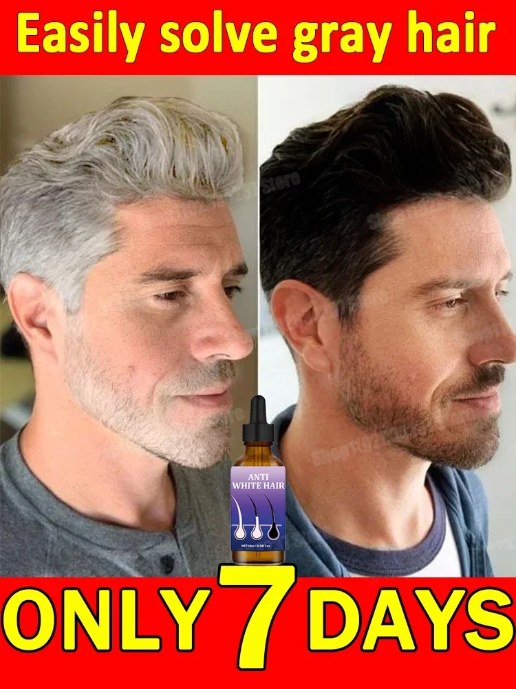 العناية بالشعر من الأبيض إلى الأسود، شعر مضاد للرمادي، إصلاح اللون الطبيعي، تغذية للرجال والنساء، منتج تساقط الشعر