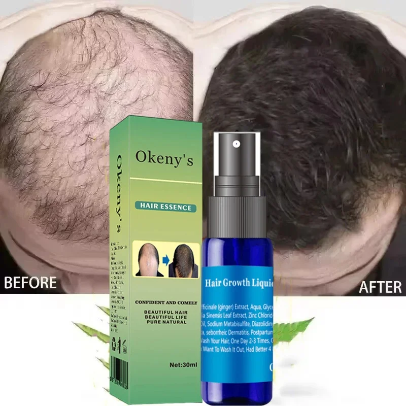 

Сыворотка для роста волос, 7 дней, необходимая капсула для быстрого восстановления волос, против выпадения волос, восстановление облысения, лечение поврежденной кожи головы для женщин и мужчин