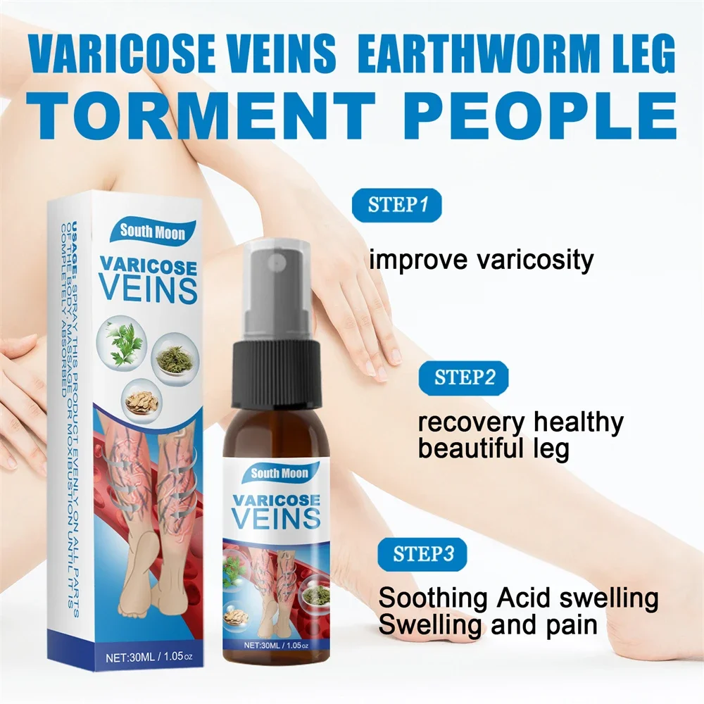 30ml Varicose Vein Spray Vasculitis Phlebitis Spider Legs Smoothing Blood Vessel Bulging Treatment Redness Leg Body Care