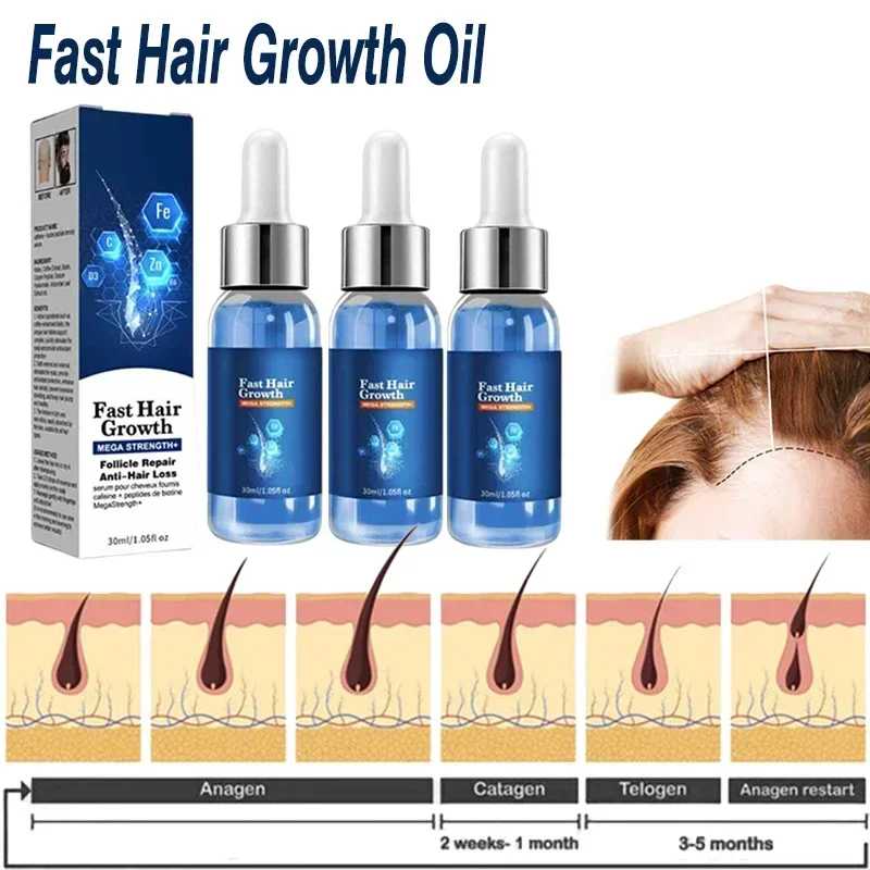 Fast Hair Growth Oil Effective Baldness Repair Hereditary Hair Loss Postpartum Seborrheic Hair Anti Loss