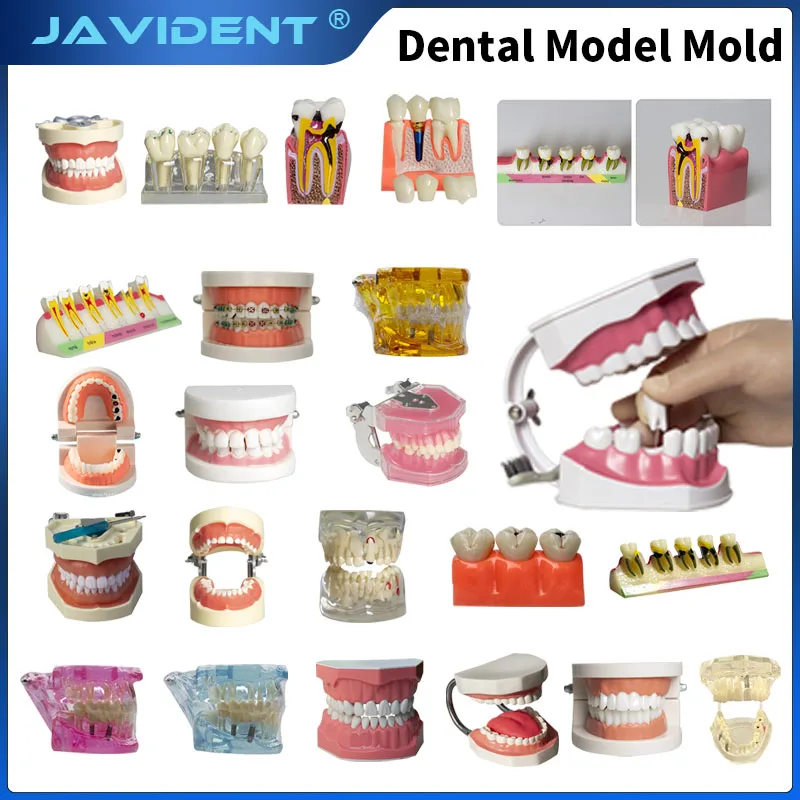 1Pcs Oral Dental Models Implant-Supported Removable Dental Models Full-Mouth Pathology Prosthodontic Patient Communication