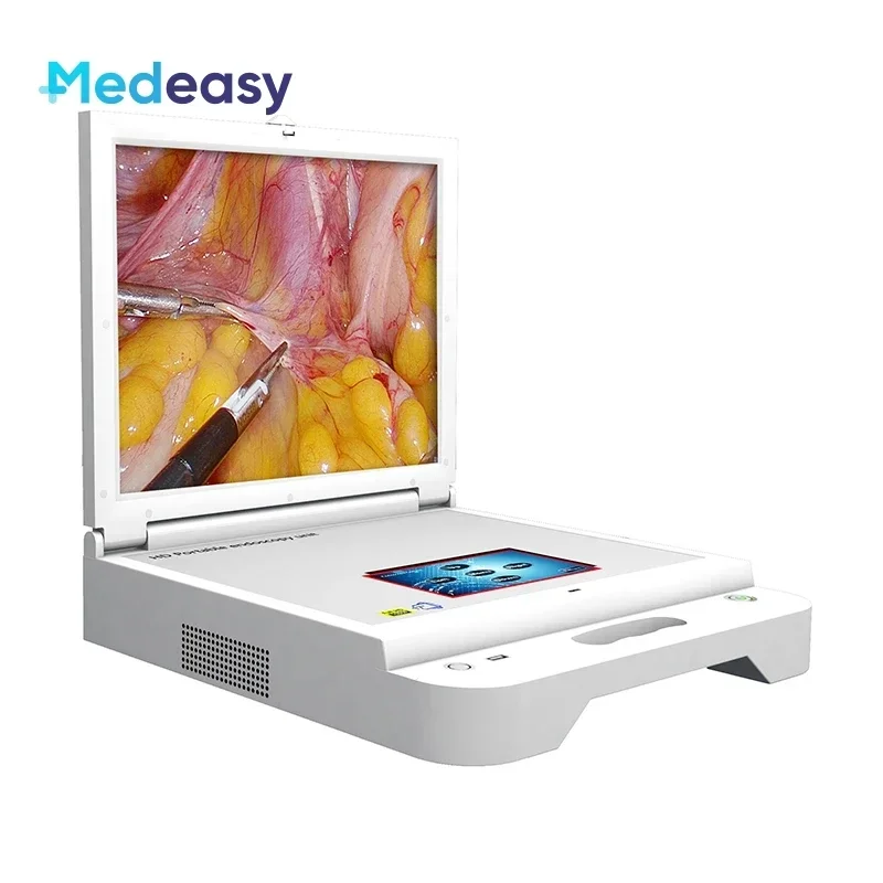 17 Inch Medical Monitor, Recorder, Led Light Source, Full HD Endoscope Camera Portable HD Endoscopy Unit