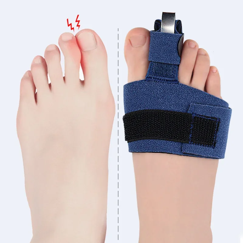 1/2/8Pcs Toe Straightener Finger Splint Corrector Wrap For Hammer Toe Bent Claw And Crooked Toe To Align Support Toes Foot Care
