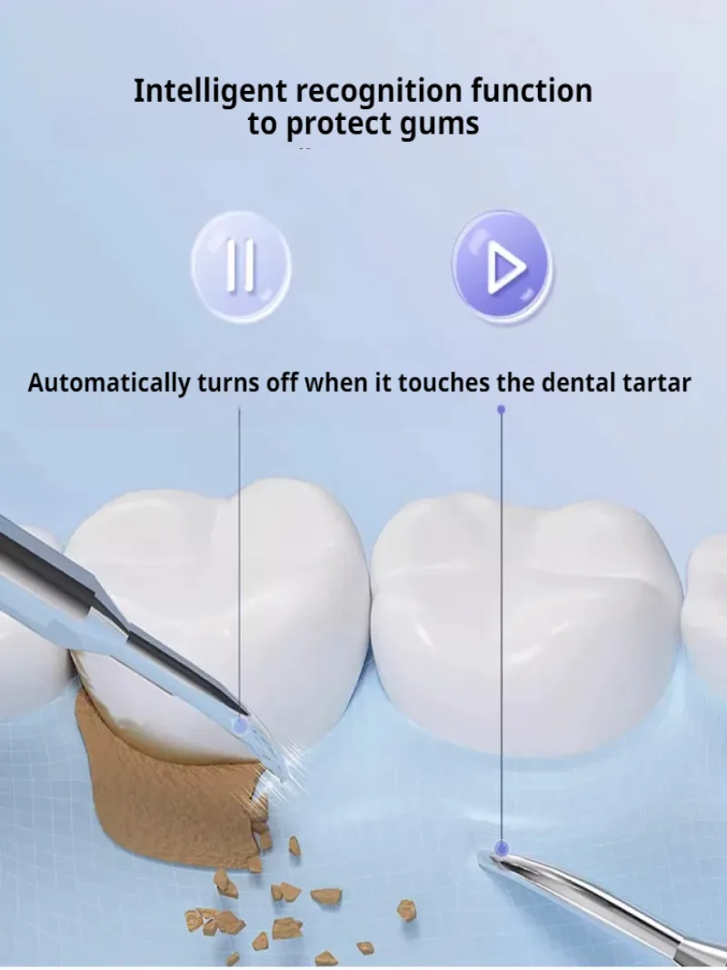 Home chasing frequency pulizia orale wireless macchie dentali ad ultrasuoni ablatore detartar visivo