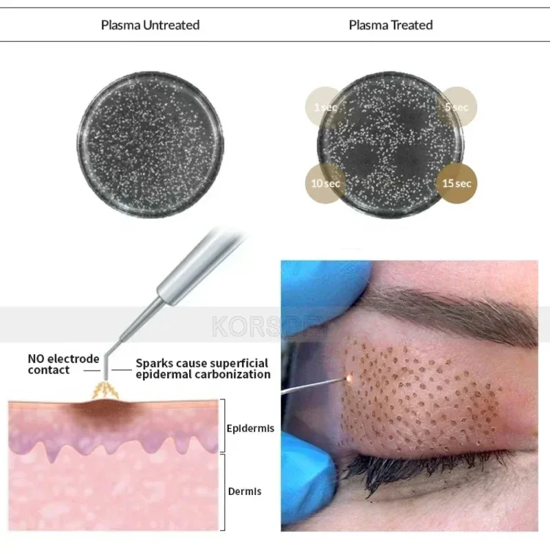 

Cold Plasma Skin Rejuvenation Repair Plume, factory direct sale, cell regeneration, pro Jet ozone facial device for beauty thera