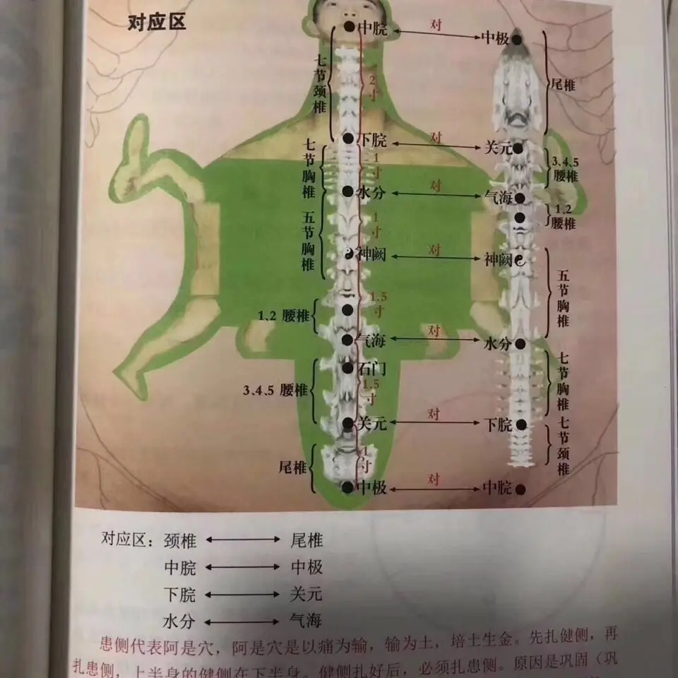 Abdominal Acupuncture Therapy Traditional Chinese Medicine Treatment Stunning Essential Printing Chinese Edition