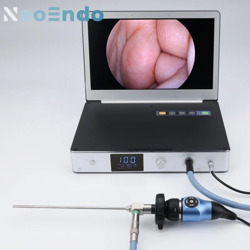 

3 In 1 Portable Medical Endoscope Camera Full HD 1080P With 11.6 Inch Monitor And 30W LED Light Source