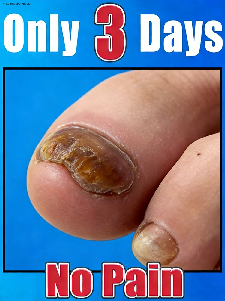 

2026 NEW Cleaning Nail Brush Tools Nail Art Manicureed Tool 2026 Hot Sale Foot Care Tools