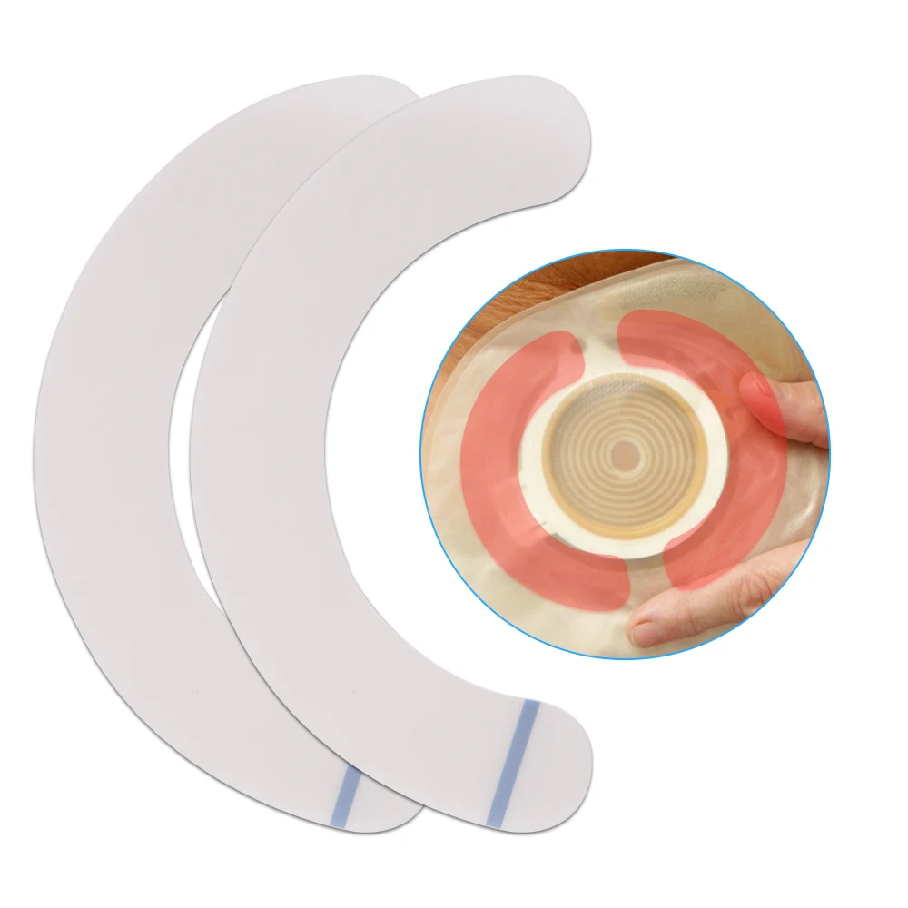 

10-50 Pcs Elastic Ostomy Barrier Strips Hydrocolloid Waterproof Leak Skin Adhesive Ostomy Barrier Tape for Colostomy Stoma Bags
