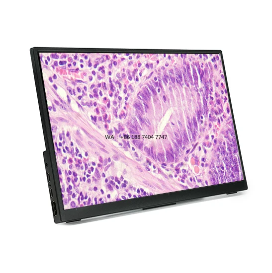 

Цифровой микроскоп BestScope BLC-280 с ЖК-дисплеем высокого разрешения, креплением C-mount, выходом HD+USB и CMOS-сенсором