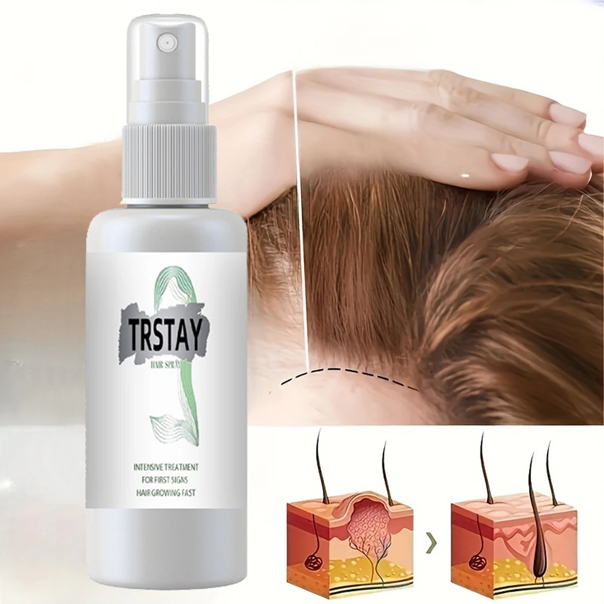 

Anti Alopecia Oil Fast Growth Hair Loss Care Product Male and Female Hair Growth Essence Thickener