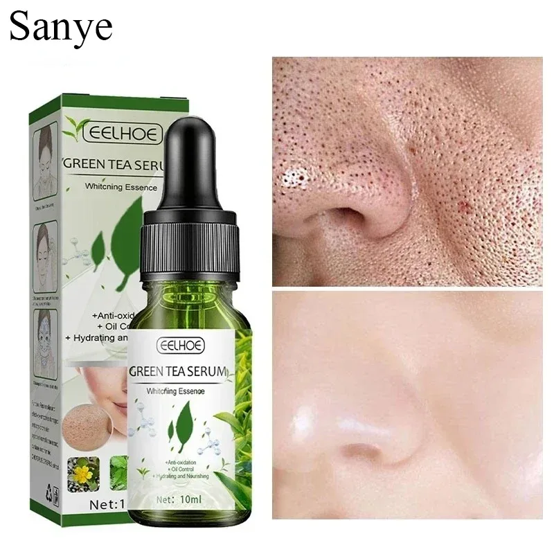 

Pore Shrink Face Serum Green Tea Oil Control Essence Remove Dark Spots Improve Acne Blackheads Serum Korean Moisturizing Care