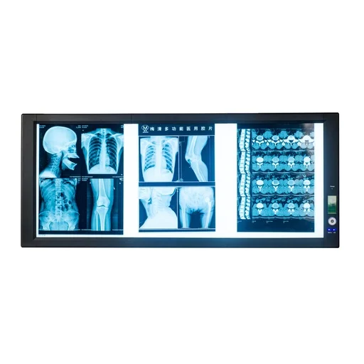 Single Viewing Light Medical LED Single Double X-ray Film Viewing Illuminator Light Viewer
