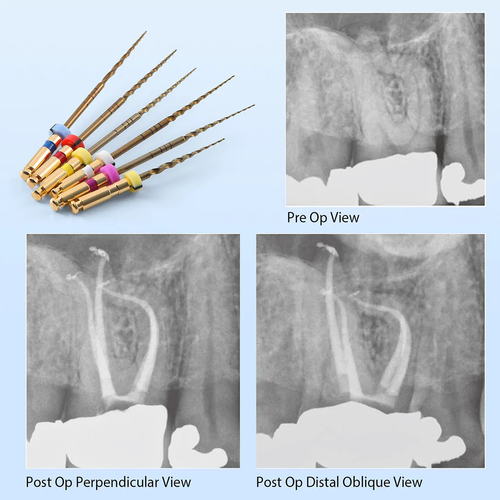 Dental Gold Flexible Feilen Endo Endodontische Wurzelkanal-Rotationsfeilen 21/25/31mm für Motoranwendung NiTi Zahnmedizinische Instrumente AZDENT – Detail 18