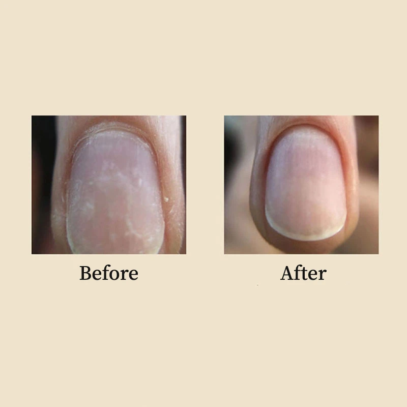 1 PC ความปลอดภัยเจาะเล็บ Bits ทังสเตนคาร์ไบด์เจาะ Bit Cuticle Remover สําหรับแฟ้มเล็บไฟฟ้าเครื่อง Cuticle เครื่องมือทําความสะอาด