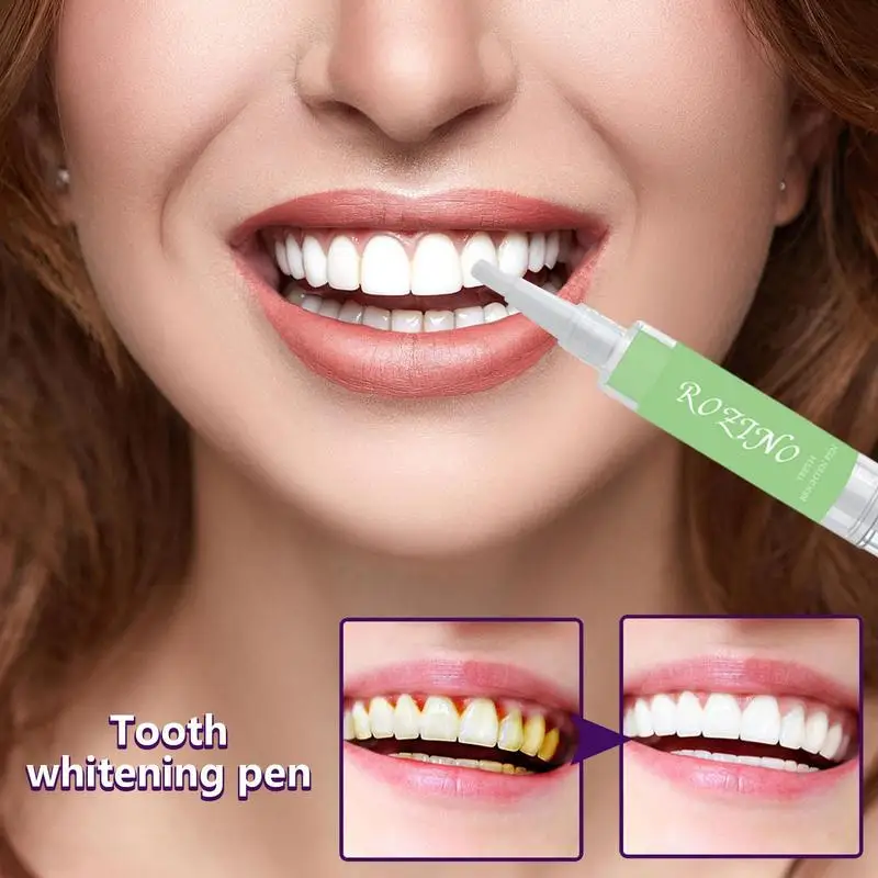 

5ml Teeth Whitening Pen Tooth Gel Whitener Bleach Remove Stains Instant Brighten Teeth Whitening Cleaning Serum Beauty Health